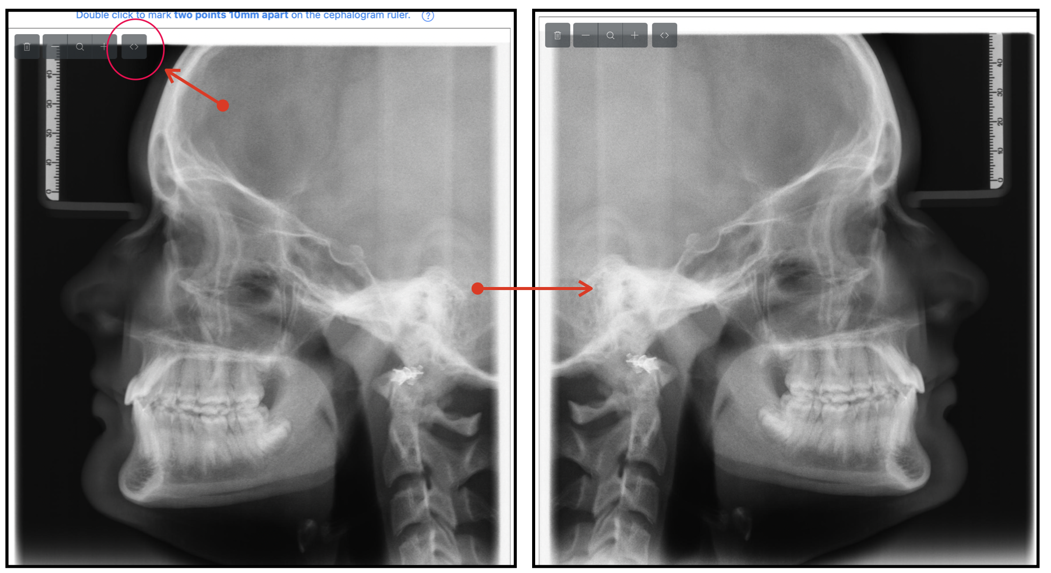 Help step 3 screenshot